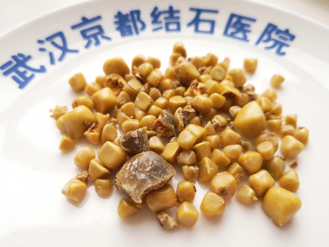 尊龙凯时人生就是博--官网入口