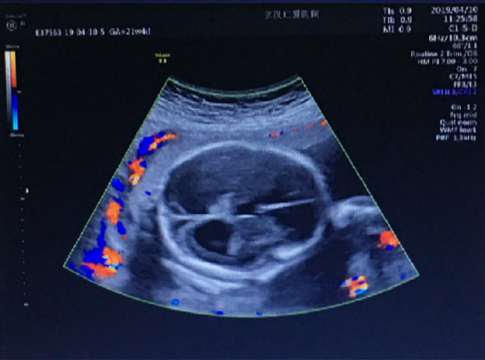 尊龙凯时人生就是博--官网入口