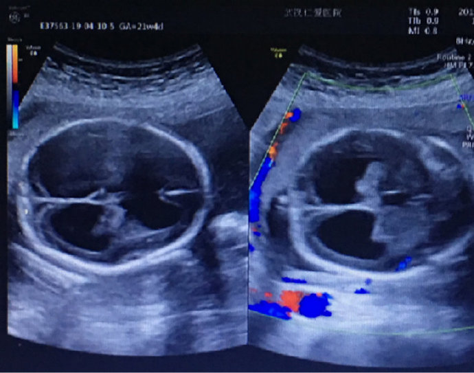 尊龙凯时人生就是博--官网入口